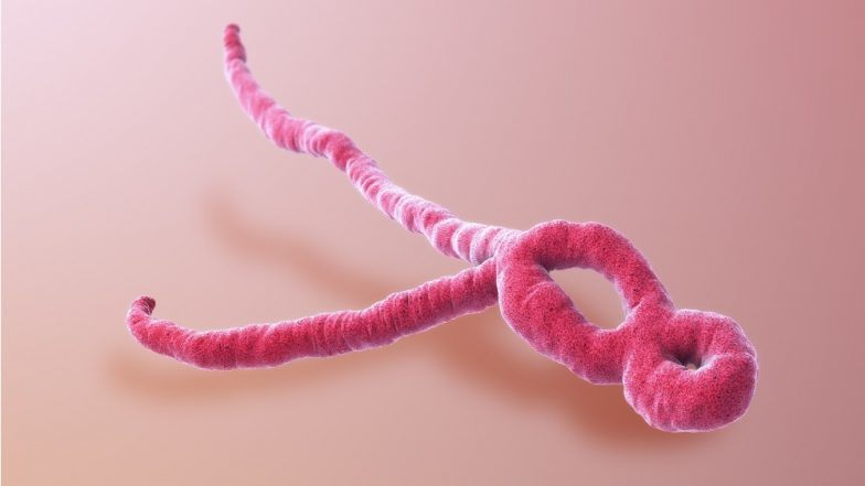 The Ebola Virus: Causes, Symptoms, Complications And How The Disease Is Treated
